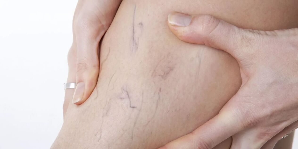 пре употребе паре вариконе